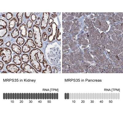 Immunohistochemistry-Paraffin: MRPS35 Antibody [NBP1-82786]