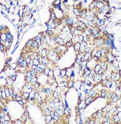 Immunohistochemistry-Paraffin: MRPS35 Antibody - Azide and BSA Free [NBP2-94003]