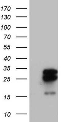 Western Blot: MRPS7 Antibody (OTI5E11) [NBP2-45433]