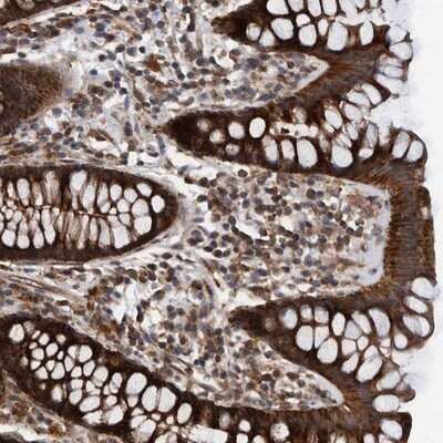 Immunohistochemistry-Paraffin: MRPS7 Antibody [NBP1-81030]