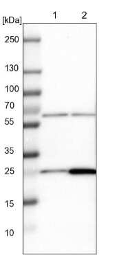 Western Blot: MRPS7 Antibody [NBP1-81029]