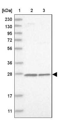 Western Blot: MRPS7 Antibody [NBP1-81030]