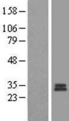 Western Blot: MRPS7 Overexpression Lysate [NBL1-13308]