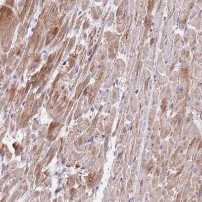Immunohistochemistry-Paraffin: MRPS9 Antibody [NBP2-30429]