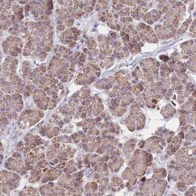 Immunohistochemistry-Paraffin: MRPS9 Antibody [NBP2-30429]