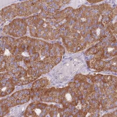 Immunohistochemistry-Paraffin: MRPS9 Antibody [NBP2-30429]
