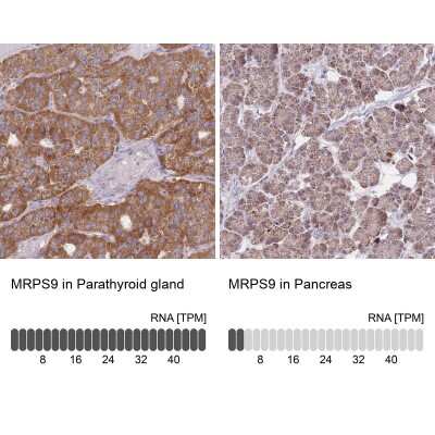 Immunohistochemistry-Paraffin: MRPS9 Antibody [NBP2-30429]