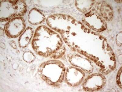 Immunohistochemistry: MRRF Antibody (OTI1D5) [NBP2-45434]