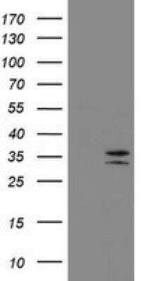 Western Blot: CD20 Antibody (OTI4B4) [NBP2-45454]