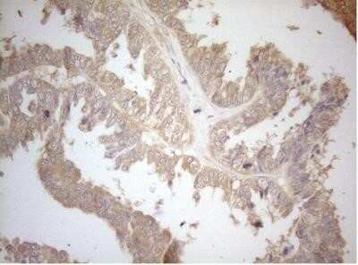 Immunohistochemistry: MS4A12 Antibody (OTI5F5) - Azide and BSA Free [NBP2-72791]