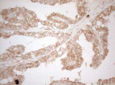 Immunohistochemistry-Paraffin: MS4A12 Antibody (OTI5F5) [NBP2-45455]