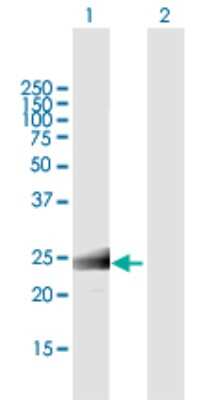Western Blot: MS4A12 Antibody [H00054860-B01P]
