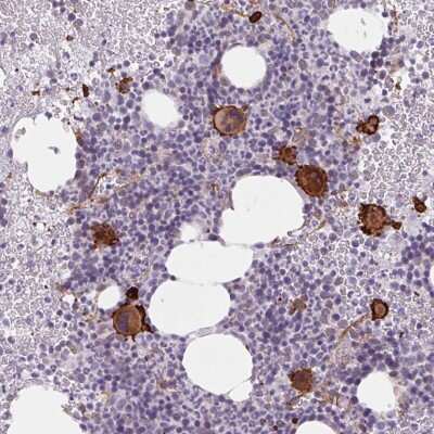 Immunohistochemistry: MS4A13 Antibody [NBP2-38997]