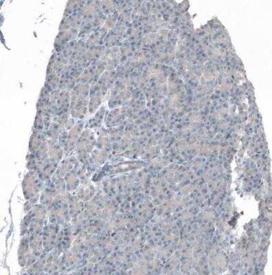 Immunohistochemistry-Paraffin: MS4A6A Antibody [NBP1-86541]