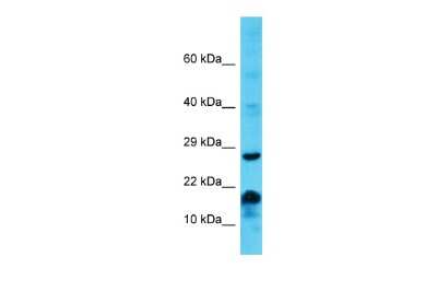 Western Blot: MS4A6E Antibody [NBP3-09575]