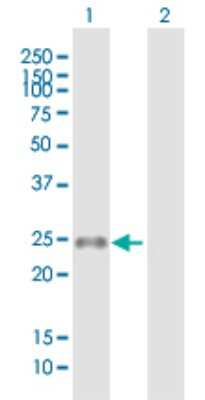 Western Blot: MS4A8B Antibody [H00083661-B01P]