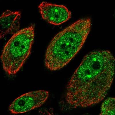 Immunocytochemistry/ Immunofluorescence: MSANTD2 Antibody [NBP1-93931]
