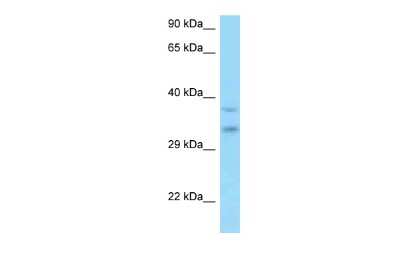 Western Blot: MSANTD3 Antibody [NBP2-87845]