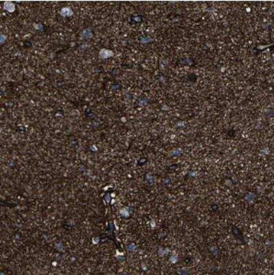 Immunohistochemistry: MSANTD4 Antibody [NBP2-30663]