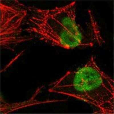Immunocytochemistry/ Immunofluorescence: MSH2 Antibody (1B3) - BSA Free [NB100-1767]