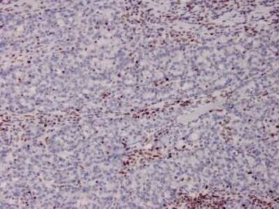 Immunohistochemistry-Paraffin: MSH2 Antibody (MSH2/2622) - Azide and BSA Free [NBP3-08957]