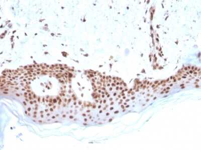 Immunohistochemistry-Paraffin: MSH2 Antibody (MSH2/2622) - Azide and BSA Free [NBP3-08957]