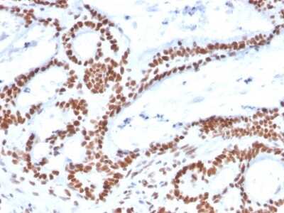 Immunohistochemistry-Paraffin: MSH2 Antibody (MSH2/2622) - Azide and BSA Free [NBP3-08957]