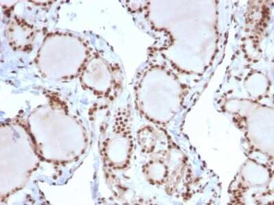 Immunohistochemistry-Paraffin: MSH2 Antibody (MSH2/2622) [NBP3-07211]