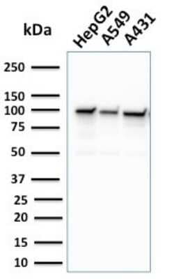 Western Blot: MSH2 Antibody (MSH2/2622) [NBP3-07211]