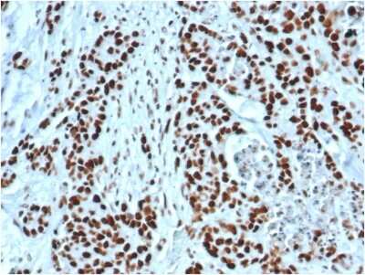 Immunohistochemistry-Paraffin: MSH2 Antibody (MSH2/6549R) - Azide and BSA Free [NBP3-08958]