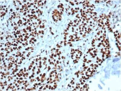 Immunohistochemistry-Paraffin: MSH2 Antibody (MSH2/6549R) - Azide and BSA Free [NBP3-08958]