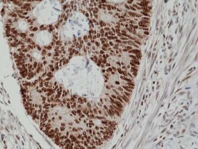 Immunohistochemistry: MSH2 Antibody (RM375) [NBP2-77433]