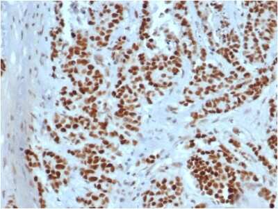 Immunohistochemistry-Paraffin: MSH2 Antibody (rMSH2/6548) - Azide and BSA Free [NBP3-08956]