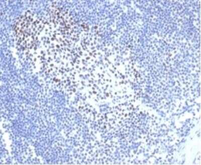 Immunohistochemistry-Paraffin: MSH2 Antibody (rMSH2/6548) - Azide and BSA Free [NBP3-08956]