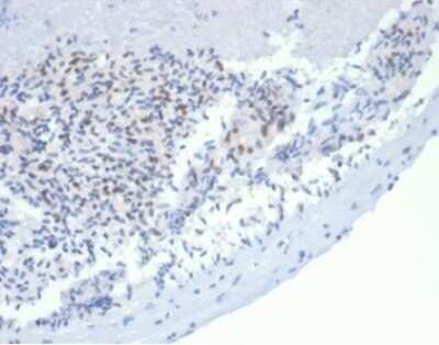 Immunohistochemistry-Paraffin: MSH2 Antibody (rMSH2/6548) - Azide and BSA Free [NBP3-08956]