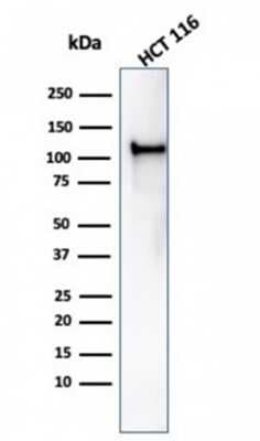 Western Blot: MSH2 Antibody (rMSH2/6548)Azide and BSA Free [NBP3-08956]