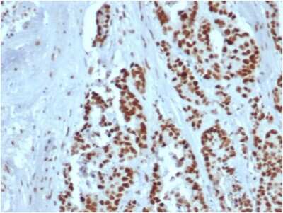 Immunohistochemistry-Paraffin: MSH2 Antibody (rMSH2/6548) [NBP3-07210]