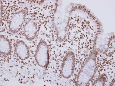 Immunohistochemistry-Paraffin: MSH3 Antibody [NBP2-19417]