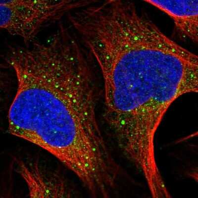 Immunocytochemistry/ Immunofluorescence: MSH5 Antibody [NBP2-57274]