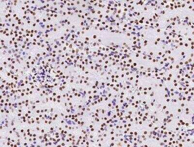 Immunohistochemistry-Paraffin: MSH6 Antibody (035) [NBP2-89265]