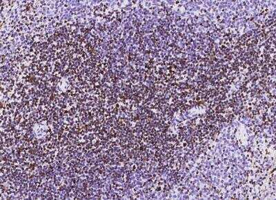 Immunohistochemistry-Paraffin: MSH6 Antibody (035) [NBP2-89265]