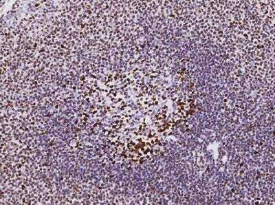 Immunohistochemistry-Paraffin: MSH6 Antibody (035) [NBP2-89265]