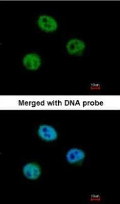 Immunocytochemistry/ Immunofluorescence: MSH6 Antibody [NBP1-33151]