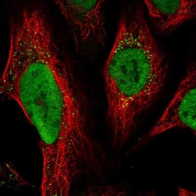 Immunocytochemistry/ Immunofluorescence: MSH6 Antibody [NBP1-83319]