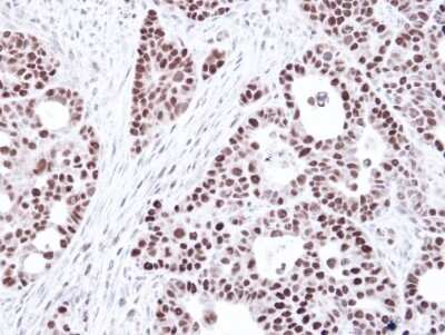 Immunohistochemistry-Paraffin: MSH6 Antibody [NBP1-33151]