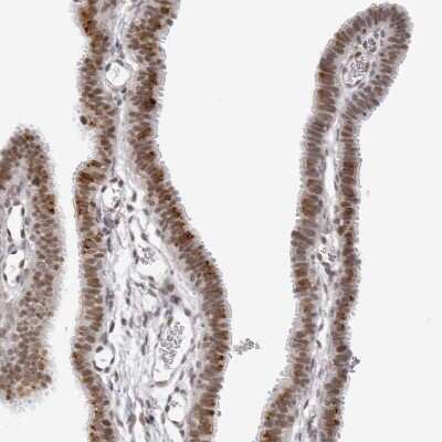 Immunohistochemistry-Paraffin: MSH6 Antibody [NBP1-83318]