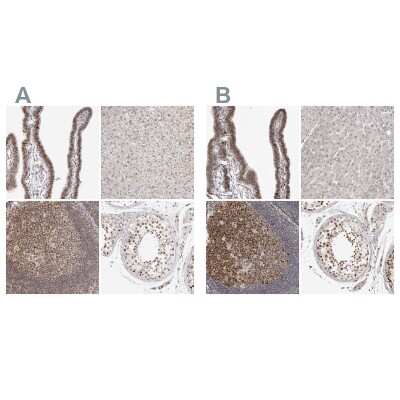 Immunohistochemistry-Paraffin: MSH6 Antibody [NBP1-83318]