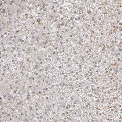 Immunohistochemistry-Paraffin: MSH6 Antibody [NBP1-83318]