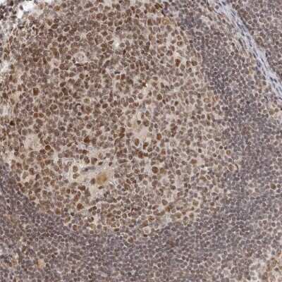 Immunohistochemistry-Paraffin: MSH6 Antibody [NBP1-83318]