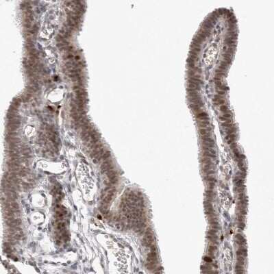 Immunohistochemistry-Paraffin: MSH6 Antibody [NBP1-83319]